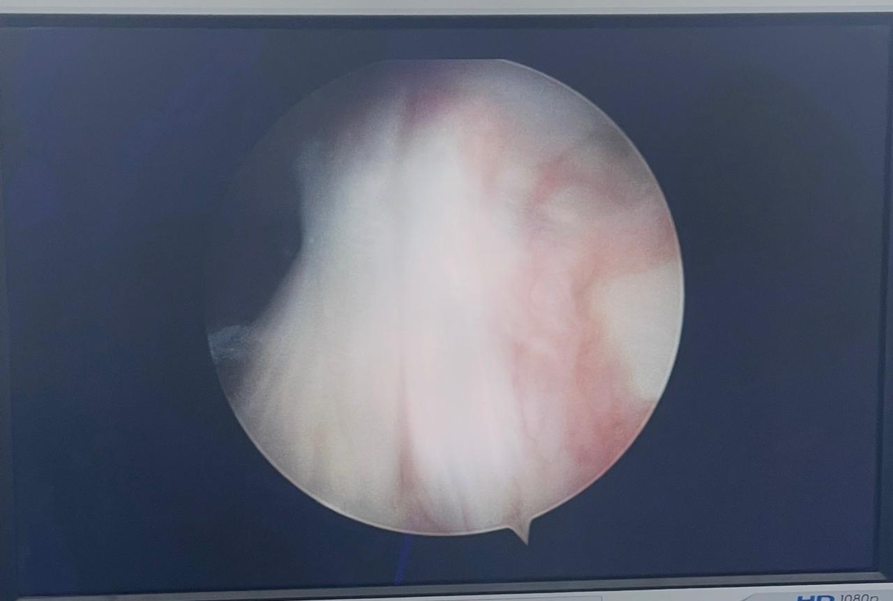 Recuperación Postquirúrgica